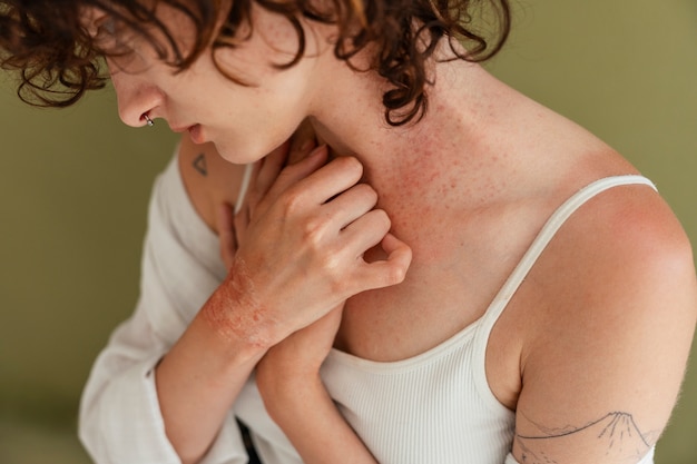 Jak rozpoznać uczulenia objawy skórne?