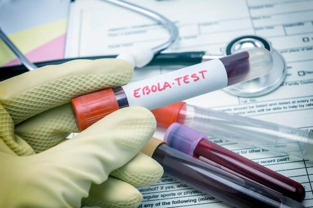 Jak odczytać wyniki testów alergicznych z krwi?