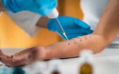 Testy alergiczne wziewne jak się robi i czego można się spodziewać?