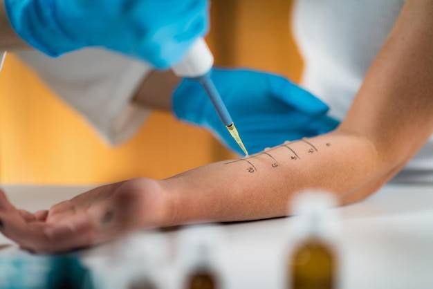 Testy alergiczne wziewne jak się robi i czego można się spodziewać?