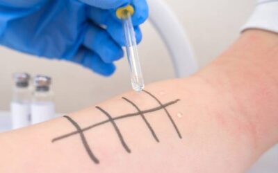 Gdzie wykonać testy alergiczne w swoim mieście?