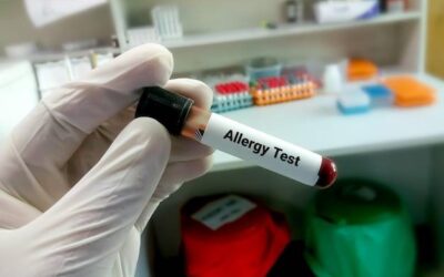 Gdzie zrobić testy na alergię pokarmową i na co zwrócić uwagę?