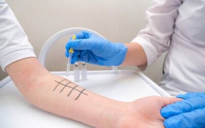 Kiedy wykonać testy alergiczne i na co zwrócić uwagę?