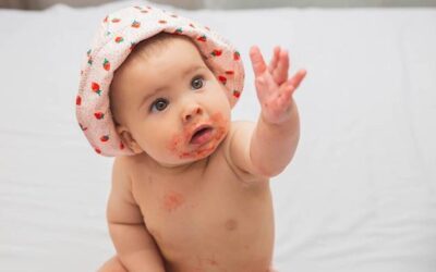 Co najczęściej uczula niemowlę i jak to rozpoznać?