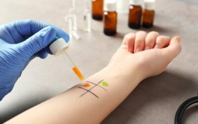 Ile kosztują testy alergiczne pokarmowe i od czego zależy cena?