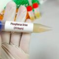 Jak przygotować się do testów alergicznych pokarmowych?