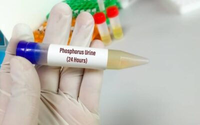 Jak przygotować się do testów alergicznych pokarmowych?