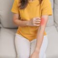Jak alergia pokarmowa objawia się na skórze i jakie zdjęcia pomagają w rozpoznaniu?
