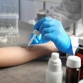 Ile kosztują testy na alergię pokarmową i kiedy warto je zrobić?